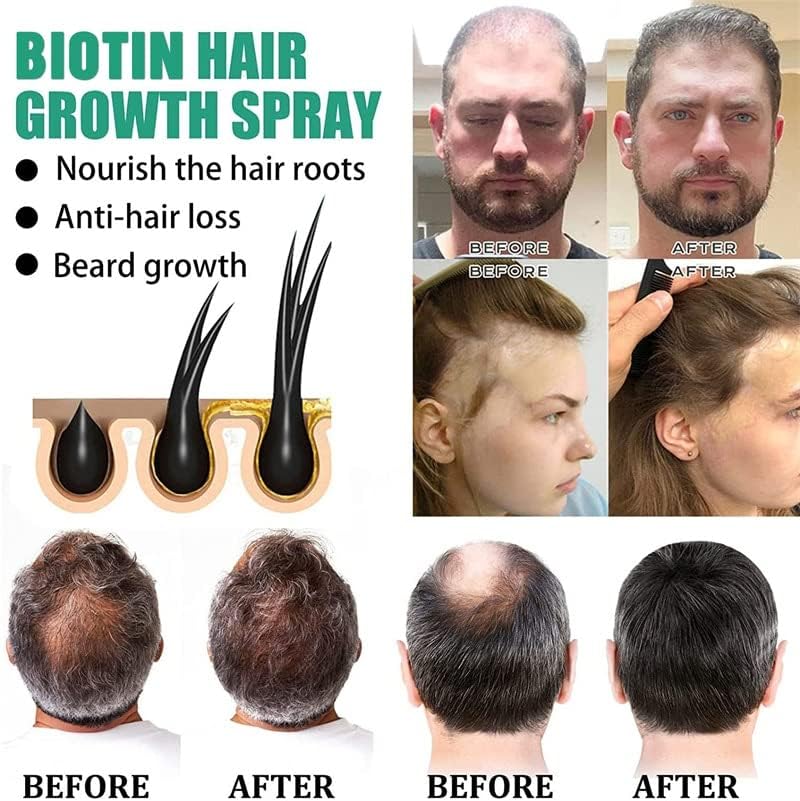 שיער צמיחת מוצרים ביוטין מהיר גידול שיער חיוני שמני אנטי שיער אובדן תרסיס קרקפת טיפול למנוע התקרחות