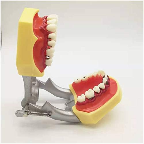 Kh66zky פתולוגיות למבוגרים מודל חניכיים השתלת שיניים ניתוח המחקר ניתוח הדגמה מודל שיניים למחקר