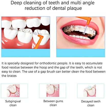 AQUR2020 60 יחידות ניקוי שיניים קיסם שיניים מברשת ניקוי בינלאומית עם ידית PP קיסמים לטיפול דרך הפה למבוגרים