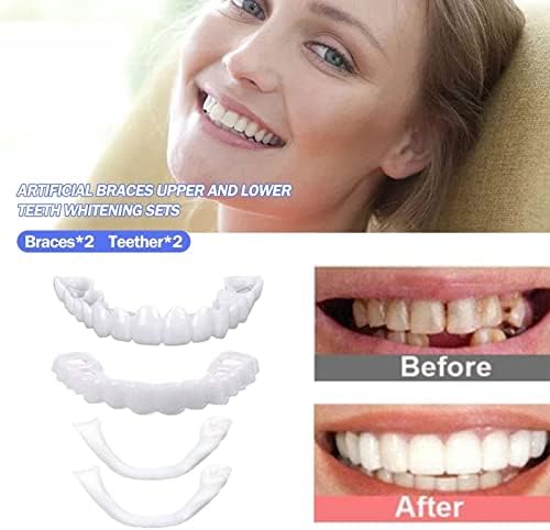 שיניים מזויפות - פורניר תותבות מתכווננות לנשים וגברים, טבע ונוח מכסים את השיניים הלא מושלמות להחזיר חיוך