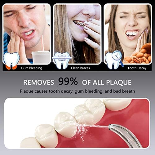 חוט דנטלי לניקוי שיניים, משטף אוראלי חשמלי עם מיכל נתיק, לחץ מתכוונן 8 טיפים לניקוי רב תכליתי לשימוש
