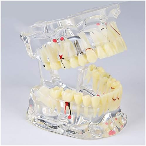 מודל שיני שיניים של לימיטה - לימוד שיניים לימוד שיניים מודל - מודל אוראלי שיניים למבוגרים - מודל לימוד שיניים