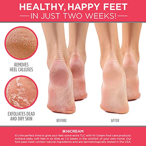 מסכת קליפת כף הרגל-2 זוגות מסכת רגל פילינג לעור רגיל לעקבים סדוקים, עור מת ויבלות, מסיר ותיקונים עקבים מחוספסים,