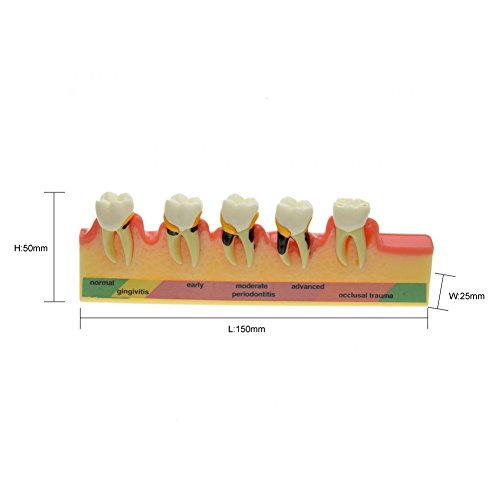 מודל שיני מחלת שיניים חניכיים, מודל הוראה של Topodont למחקר אנטומיה של שיניים שיניים