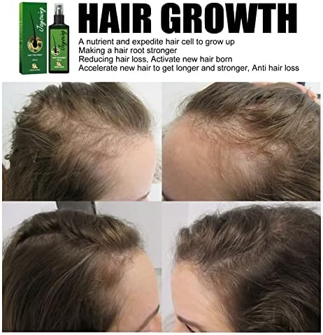 120 מ ל שיער צמיחת סרום ספריי לגברים נשים, טבעי צמחים ג ' ינג ' ר סרום שיער לצמיחה מחודשת קרם לשיער טיפול,